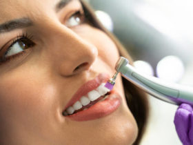 TEMPORARY TOOTH REPAIR or REPLACE KIT DIY makes 25-30 teeth *No Adhesive  needed*
